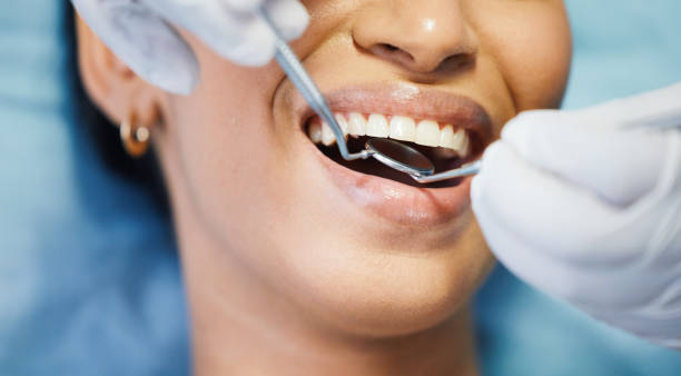 Best Emergency Dental Services for Seniors in Burkburnett, TX